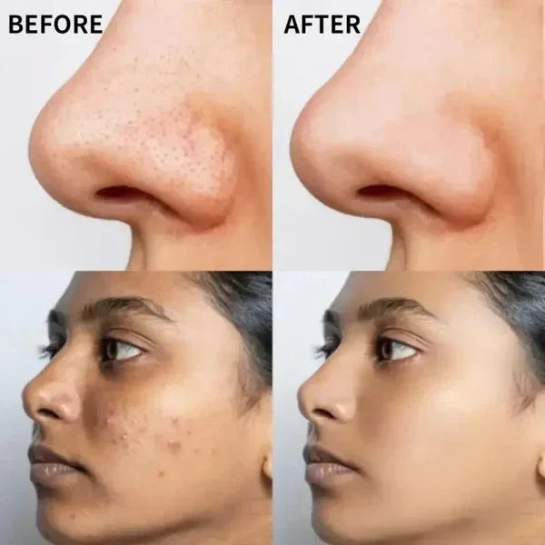 The Ordinary Vitamin C Suspension 30% in Silicone β Brightening Serum for Radiant, Even-Toned Skin (Imported Quality)
