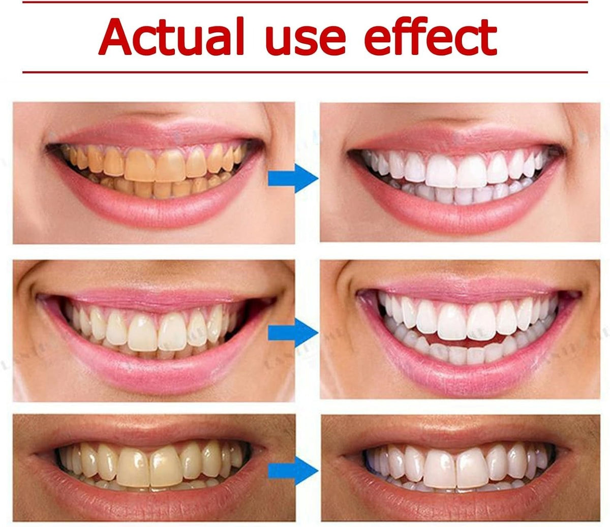 Yayashi SP-4 Ultra Whitening Toothpaste 150 ml